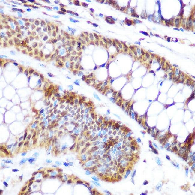 SP3 Antibody in Immunohistochemistry (Paraffin) (IHC (P))