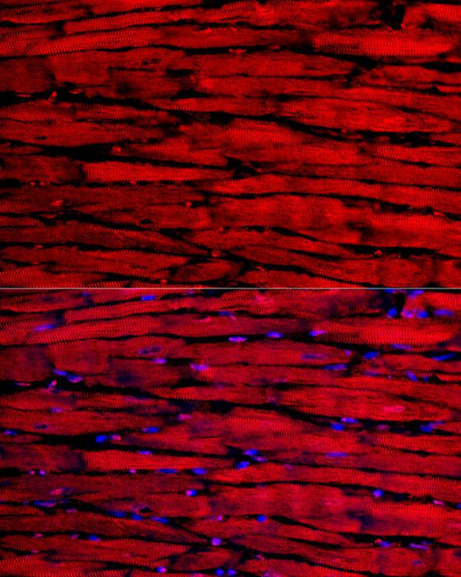 MYH6 Antibody in Immunocytochemistry (ICC/IF)