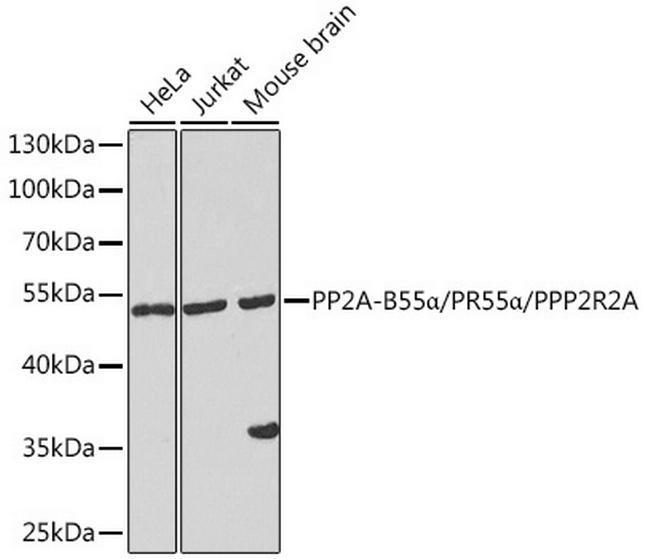 PPP2R2A Antibody in Western Blot (WB)