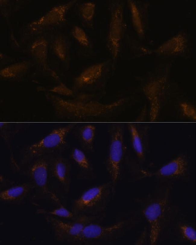 UCP4 Antibody in Immunocytochemistry (ICC/IF)