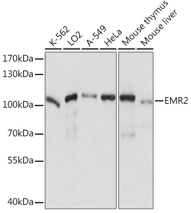 EMR2 Antibody in Western Blot (WB)