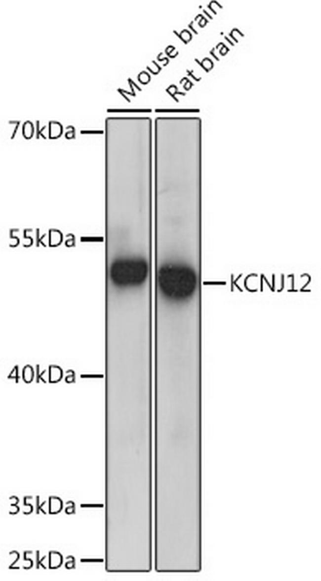 Kir2.2 (KCNJ12) Antibody in Western Blot (WB)