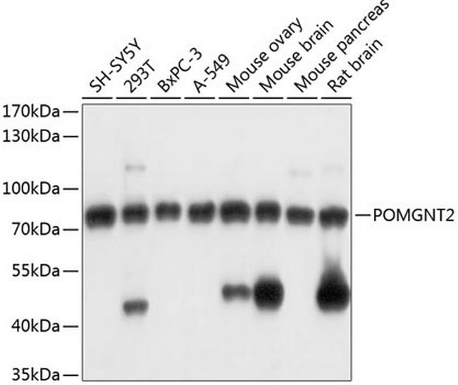 POMGNT2 Antibody in Western Blot (WB)