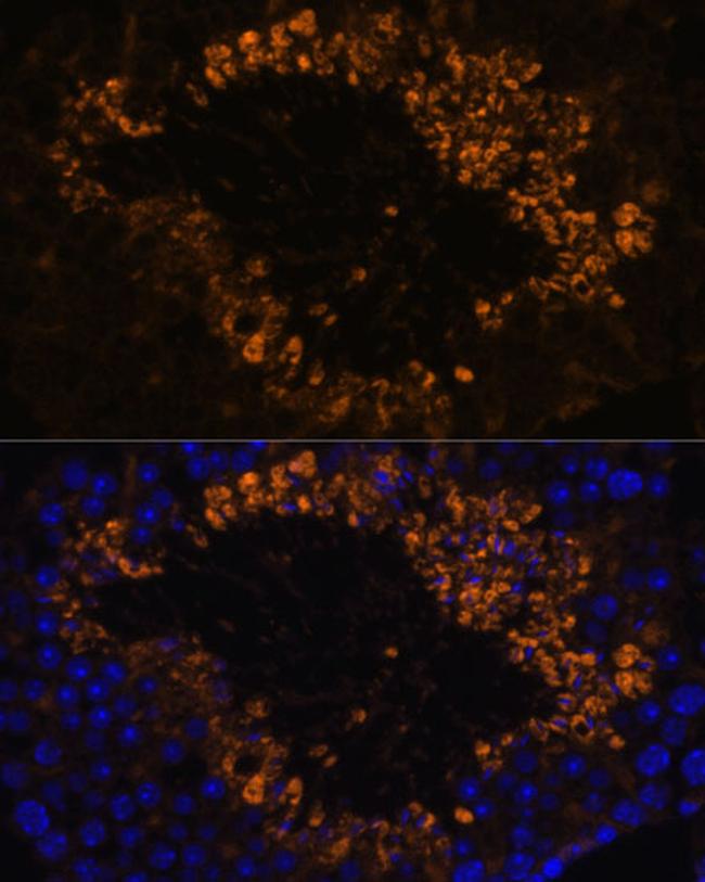 OXCT2 Antibody in Immunohistochemistry (Paraffin) (IHC (P))