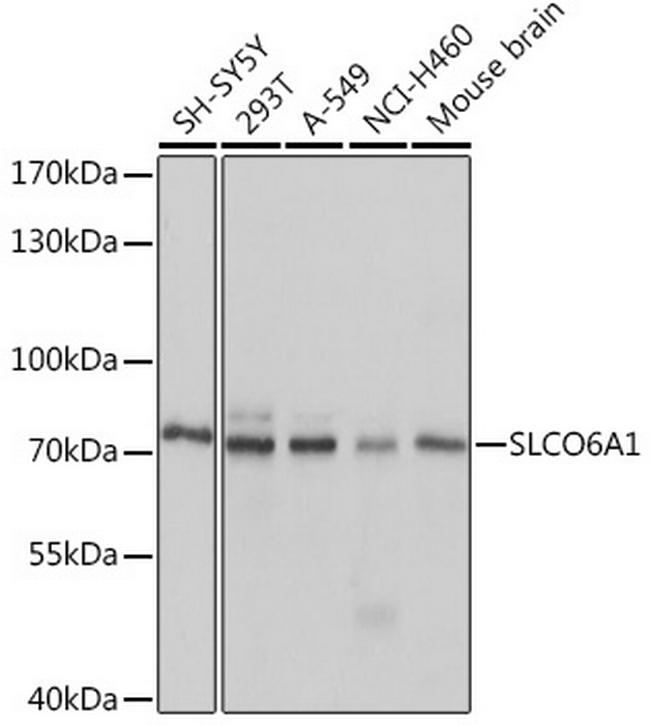 SLCO6A1 Antibody in Western Blot (WB)