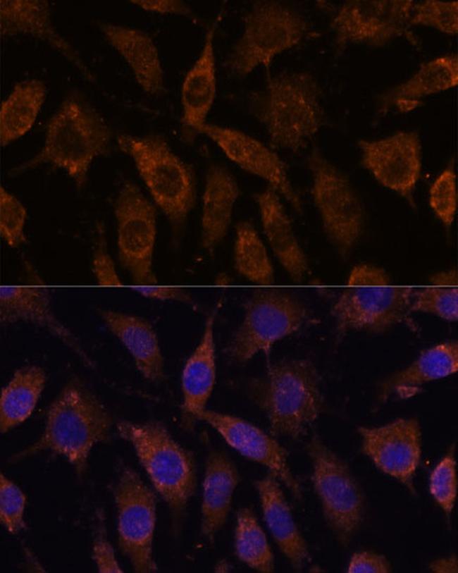 SUCLG1 Antibody in Immunocytochemistry (ICC/IF)