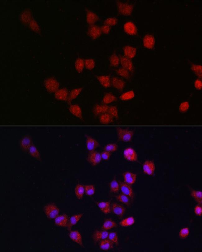 APC11 Antibody in Immunocytochemistry (ICC/IF)