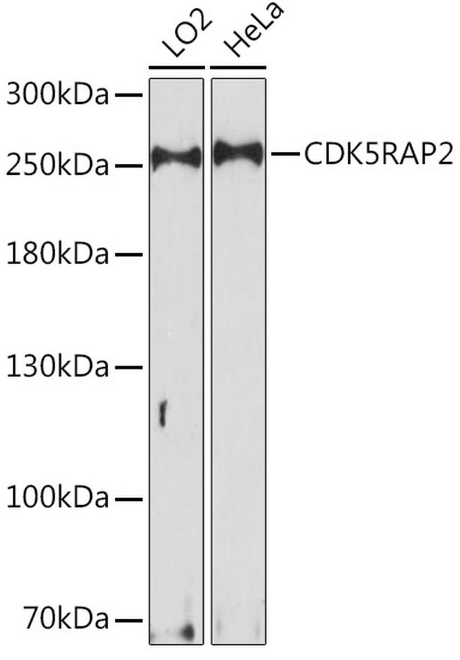 CDK5RAP2 Antibody in Western Blot (WB)