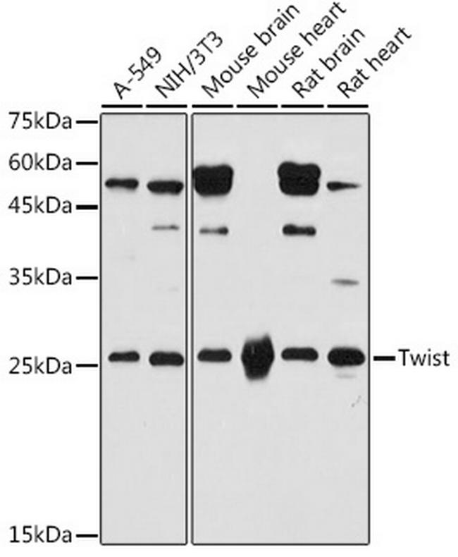 TWIST1 Antibody in Western Blot (WB)