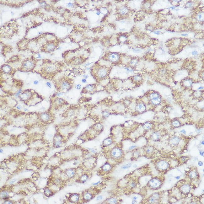 NDUFA4 Antibody in Immunohistochemistry (Paraffin) (IHC (P))