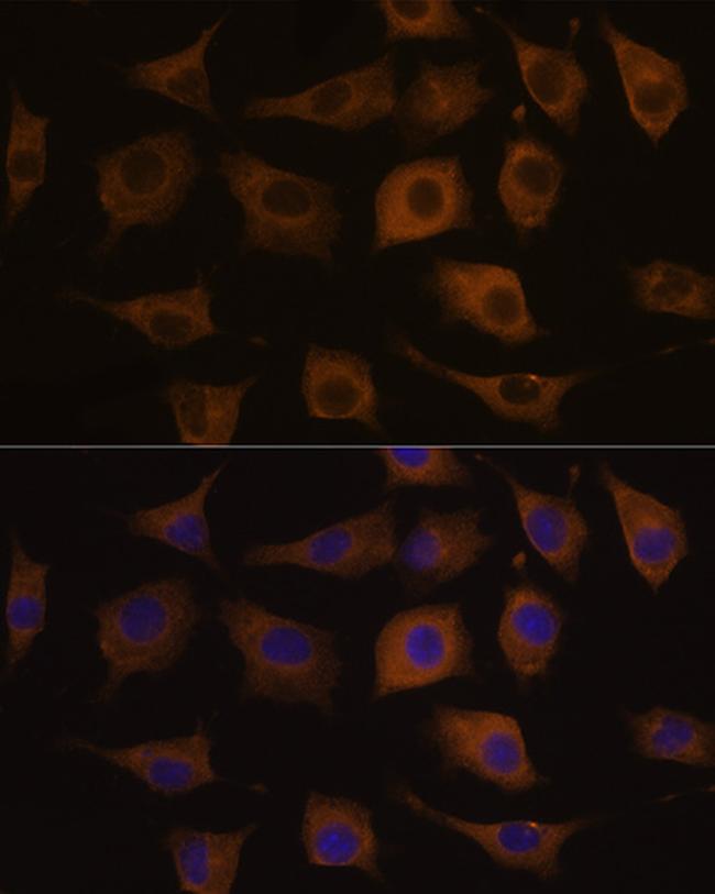 CHRNA7 Antibody in Immunocytochemistry (ICC/IF)