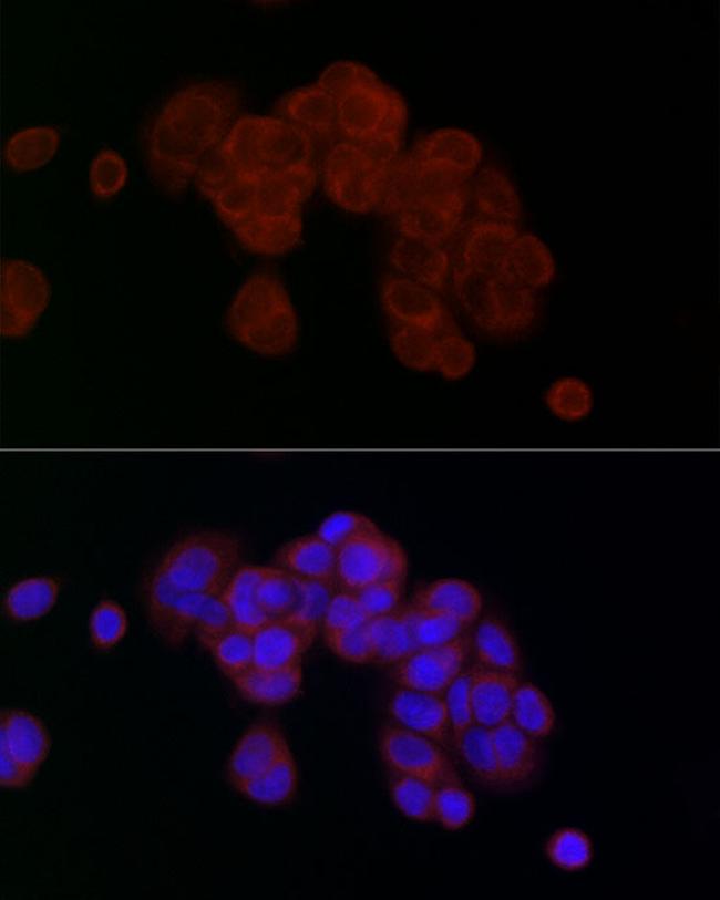 PGAM5 Antibody in Immunocytochemistry (ICC/IF)