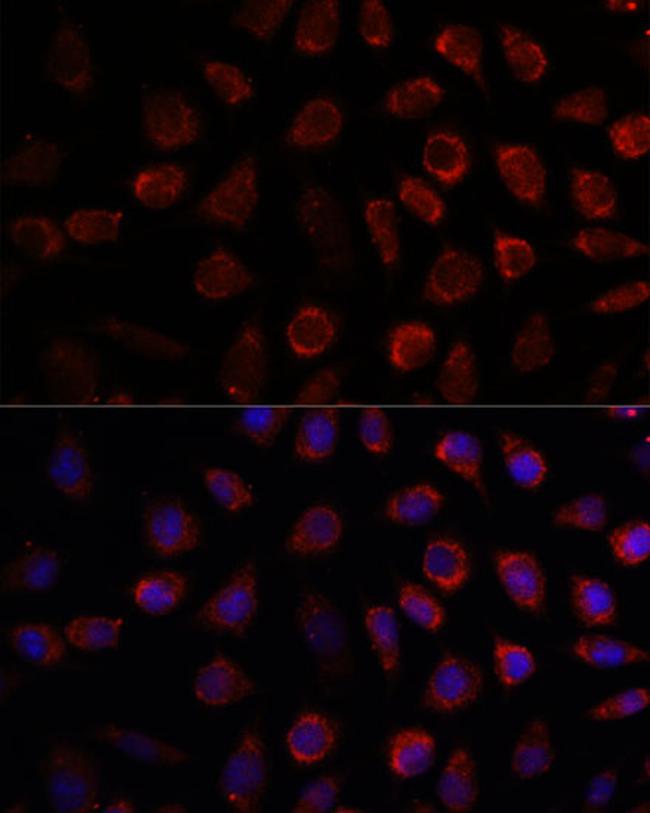 PDE11A Antibody in Immunocytochemistry (ICC/IF)