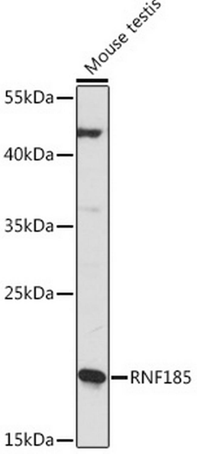 RNF185 Antibody in Western Blot (WB)