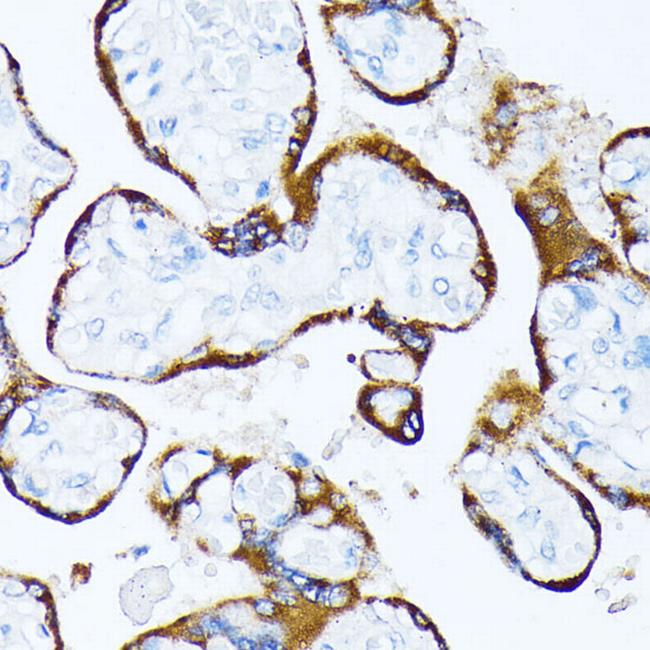 CK1 alpha Antibody in Immunohistochemistry (Paraffin) (IHC (P))