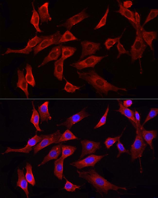 HMGCR Antibody in Immunocytochemistry (ICC/IF)