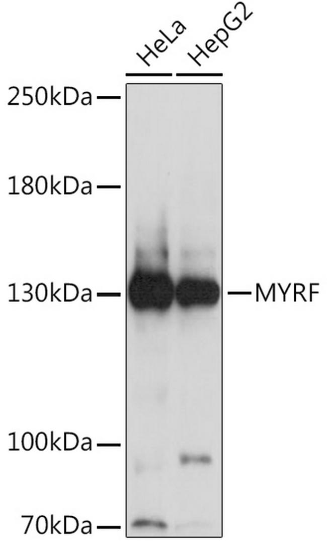 C11orf9 Antibody in Western Blot (WB)