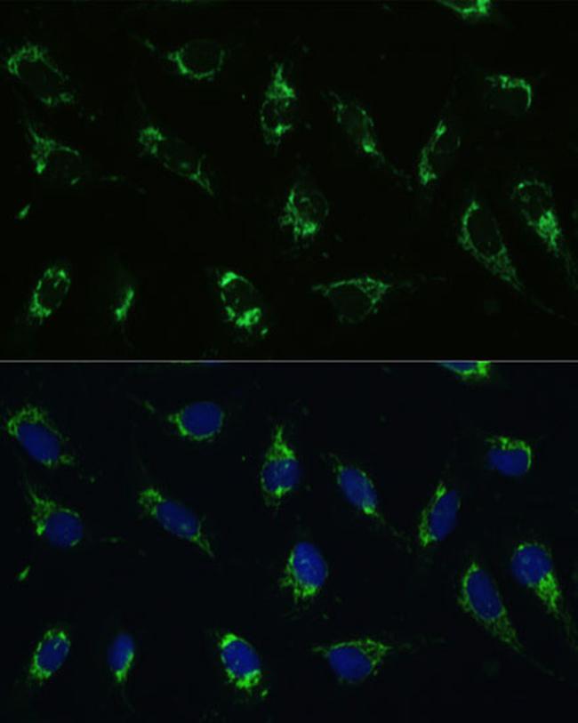 ATP5I Antibody in Immunocytochemistry (ICC/IF)