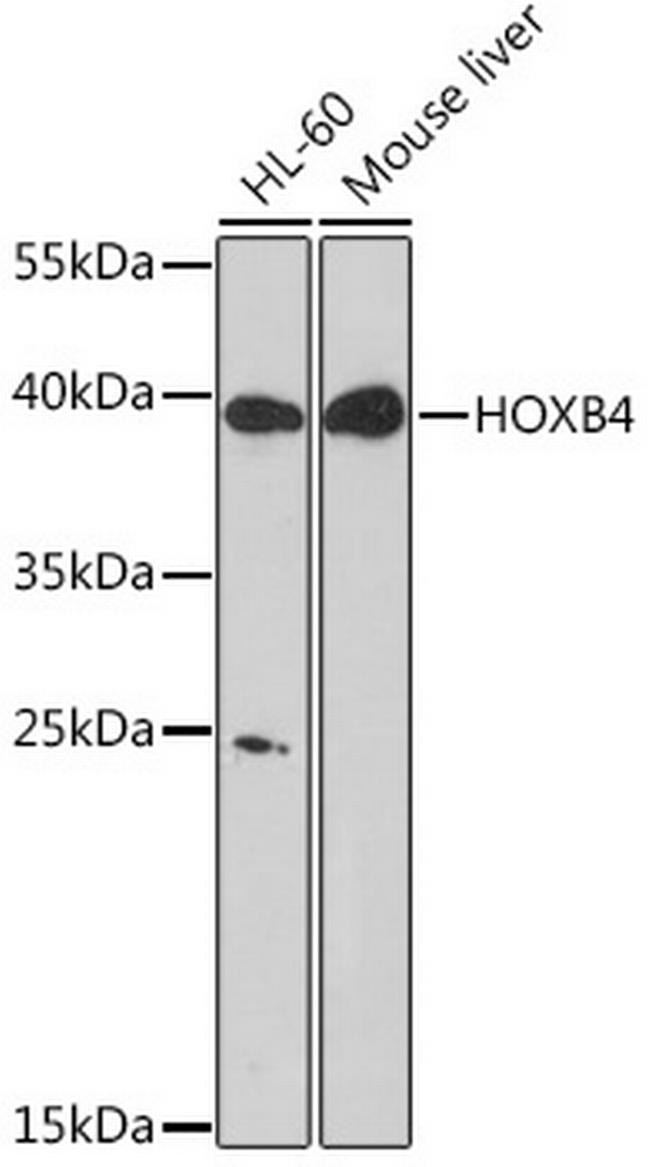 HOXB4 Antibody in Western Blot (WB)