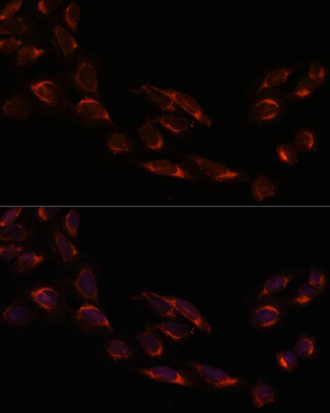 NSDHL Antibody in Immunocytochemistry (ICC/IF)