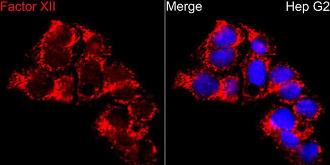 Factor XII Antibody in Immunocytochemistry (ICC/IF)