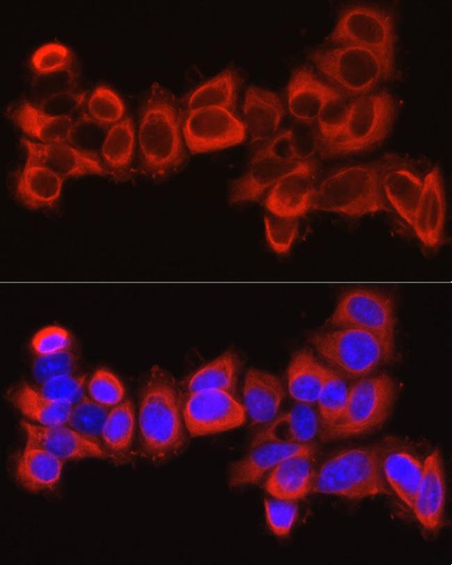 MMP13 Antibody in Immunocytochemistry (ICC/IF)