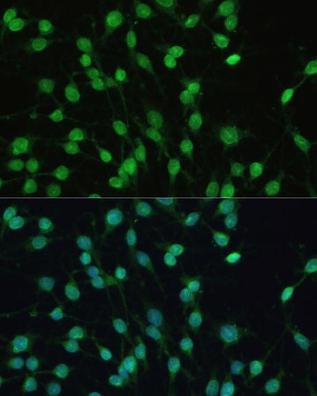 PXR Antibody in Immunocytochemistry (ICC/IF)