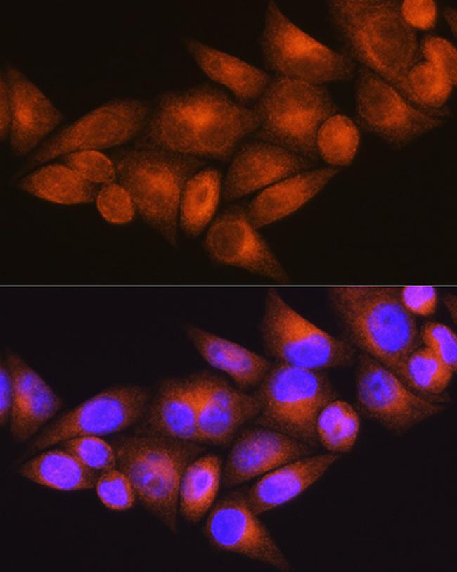 WFS1 Antibody in Immunocytochemistry (ICC/IF)