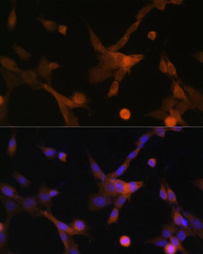 PUMA alpha Antibody in Immunocytochemistry (ICC/IF)