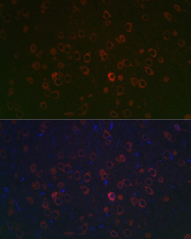 REEP2 Antibody in Immunohistochemistry (Paraffin) (IHC (P))