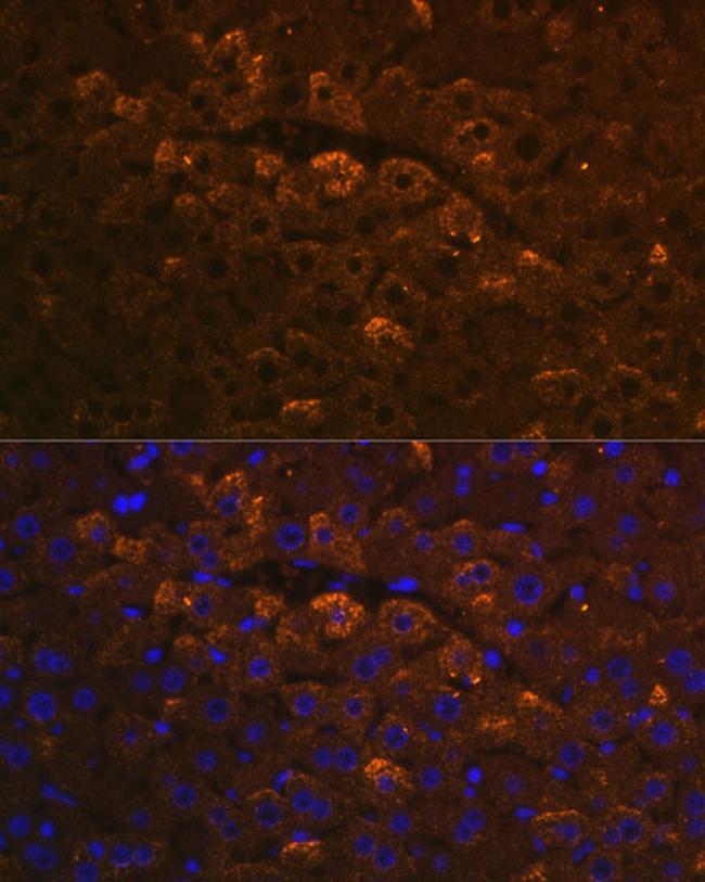 UGT1A6 Antibody in Immunohistochemistry (Paraffin) (IHC (P))