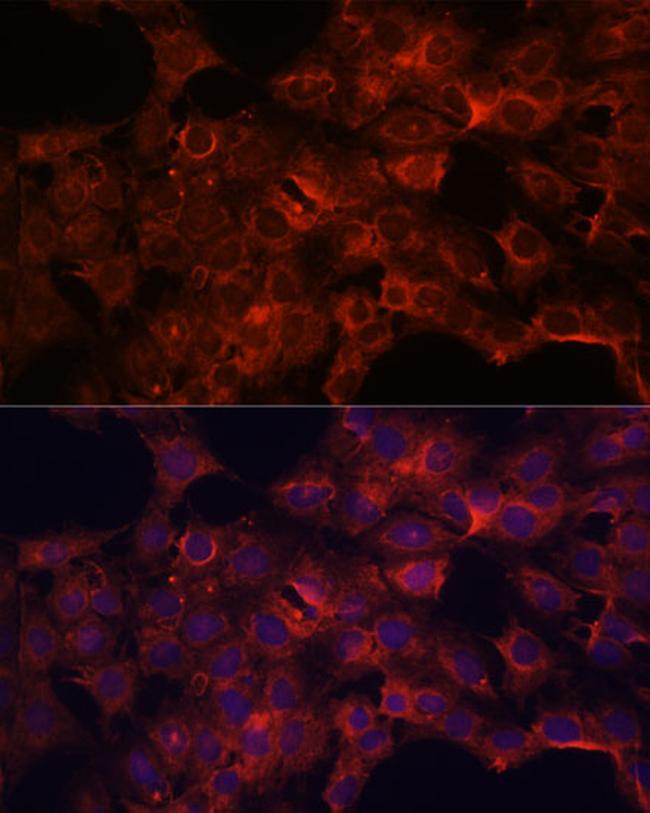 PDP2 Antibody in Immunocytochemistry (ICC/IF)