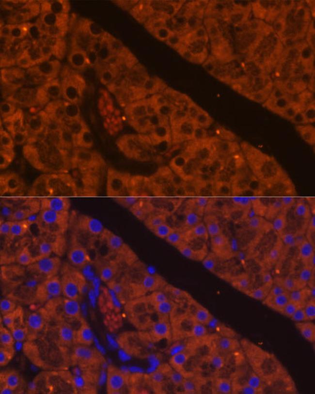 CELA2A Antibody in Immunohistochemistry (Paraffin) (IHC (P))