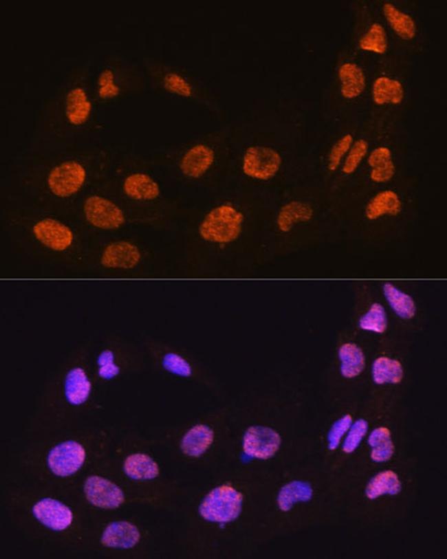 MAML2 Antibody in Immunocytochemistry (ICC/IF)