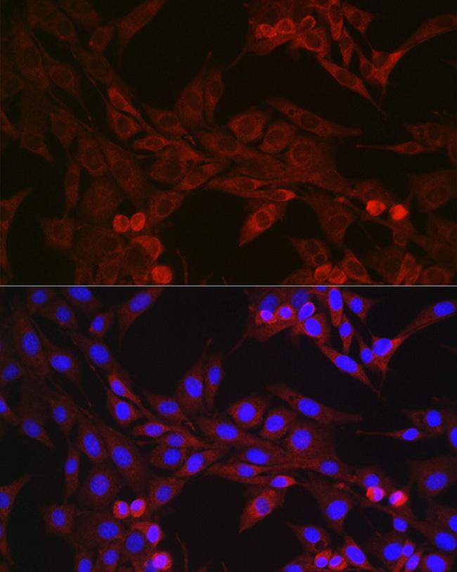 GSDMD Antibody in Immunocytochemistry (ICC/IF)