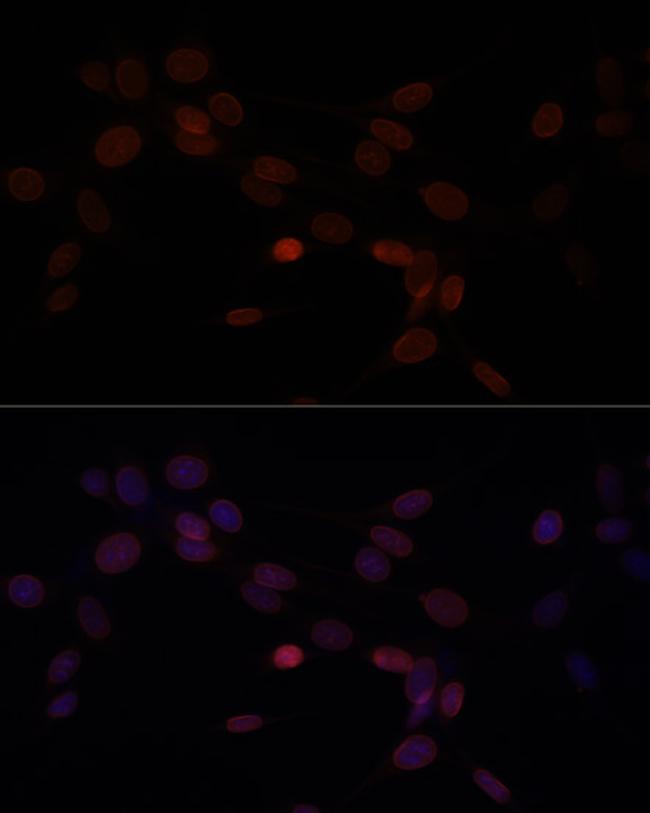 Lamin A/C Antibody in Immunocytochemistry (ICC/IF)