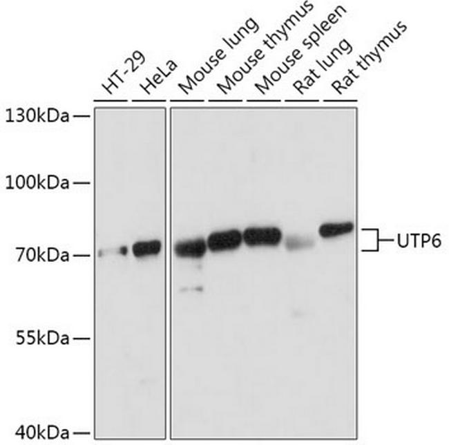 UTP6 Antibody in Western Blot (WB)