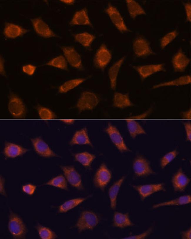 CAMSAP1 Antibody in Immunocytochemistry (ICC/IF)