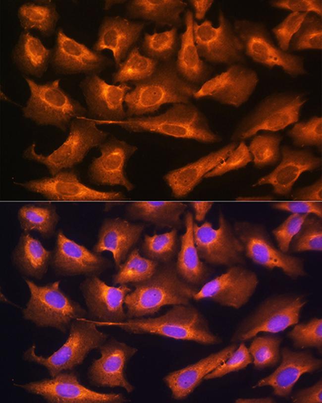 RPS28 Antibody in Immunocytochemistry (ICC/IF)