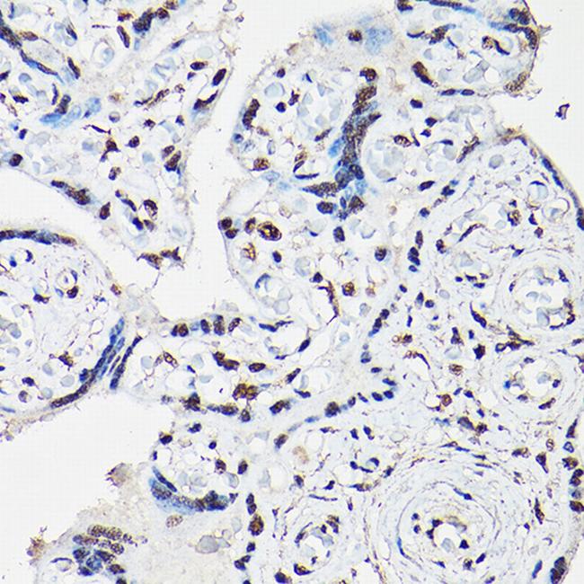 FOXO1/FOXO3/FOXO4 Antibody in Immunohistochemistry (Paraffin) (IHC (P))