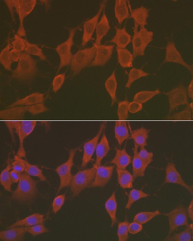 FNDC5 Antibody in Immunocytochemistry (ICC/IF)