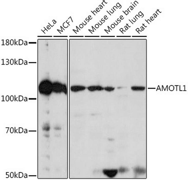 AMOTL1 Antibody in Western Blot (WB)