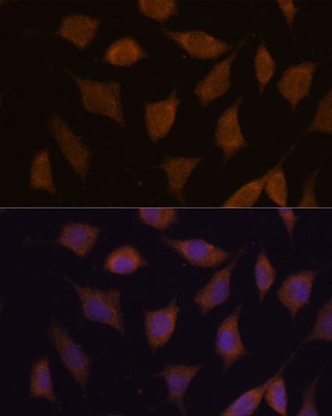 FBXW8 Antibody in Immunocytochemistry (ICC/IF)