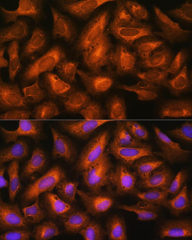 EIF2B4 Antibody in Immunocytochemistry (ICC/IF)