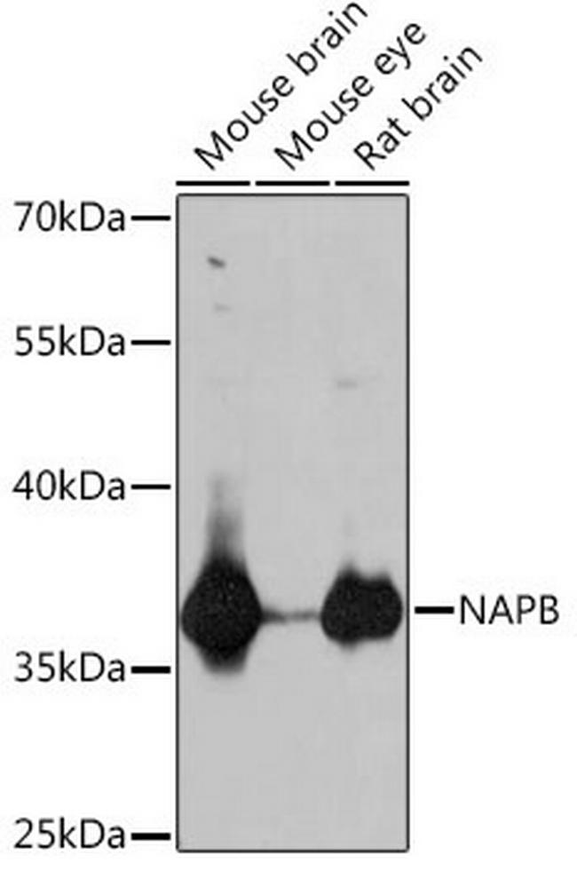 NAPB Antibody in Western Blot (WB)