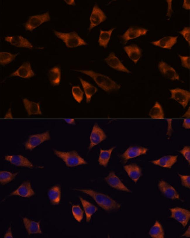 GRSF1 Antibody in Immunocytochemistry (ICC/IF)