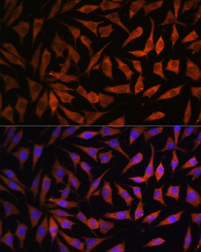 RPS8 Antibody in Immunocytochemistry (ICC/IF)