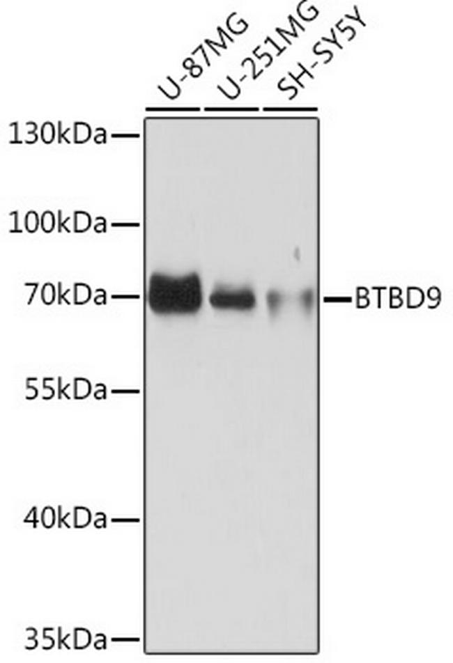 BTBD9 Antibody in Western Blot (WB)