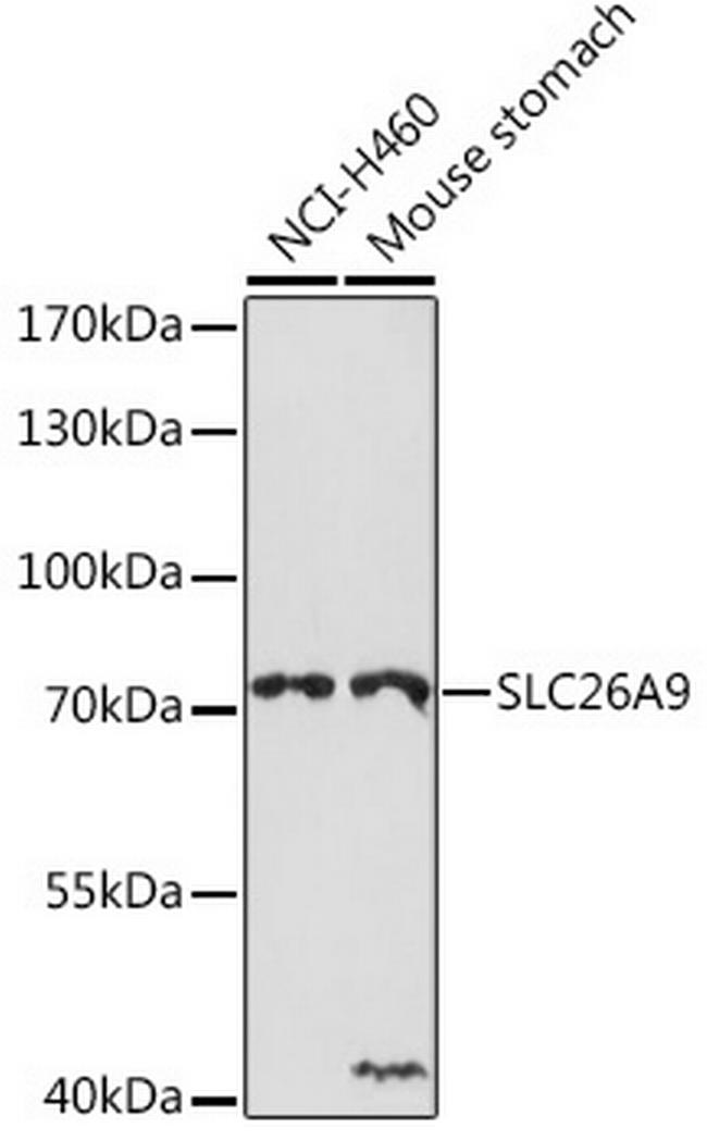 SLC26A9 Antibody in Western Blot (WB)