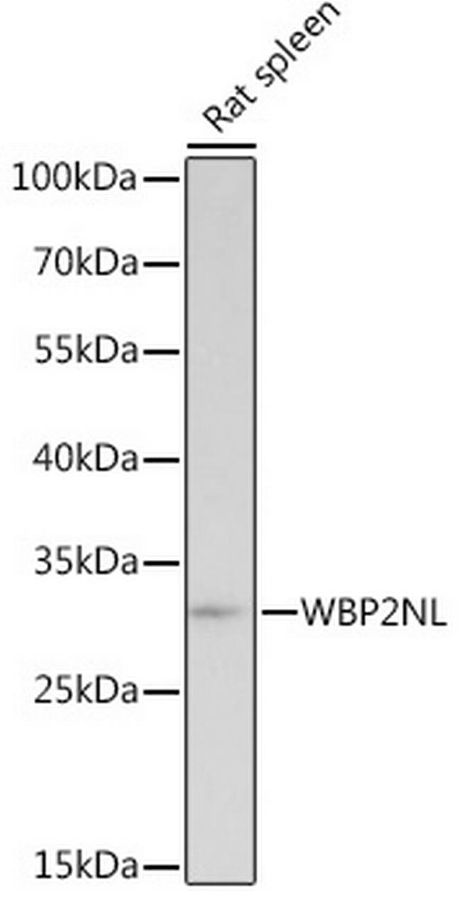 WBP2NL Antibody in Western Blot (WB)